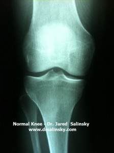 normal-knee-dr-salinsky-florida